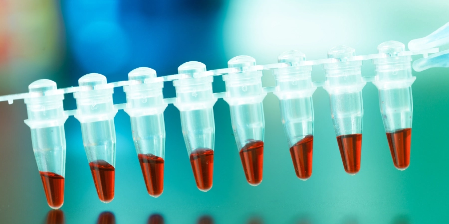 Blood research in medical tube.