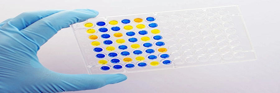Medic holding a sample case for testing for immunology.