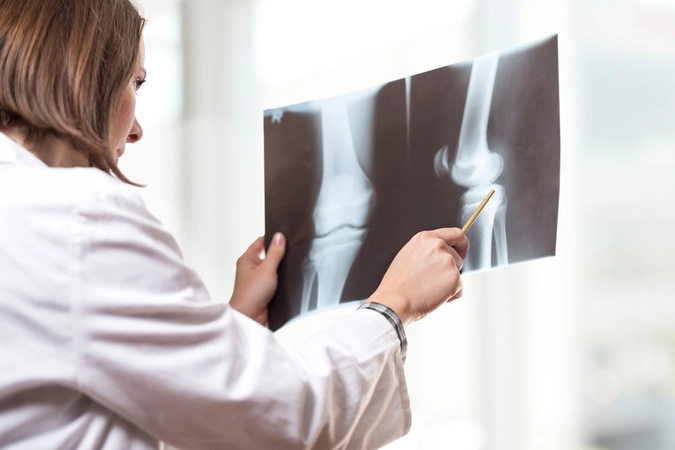 doctor looking at xray image