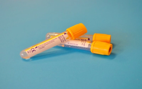 First patient in Ireland receives ground-breaking cell therapy for blood cancer
