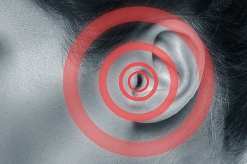 New technique to help the brain &lsquo;unlearn&rsquo; phantom perceptions to be discussed at tinnitus conference