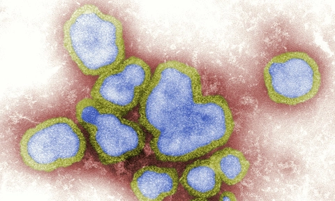 Scientists unpick how lung cells induce immune response to influenza 
