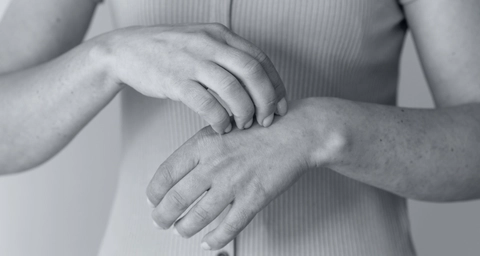 Scientists unearth potential new target for treating debilitating skin disease