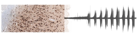 &ldquo;Live&rdquo; human brain biosamples to revolutionise translational neuroscience research