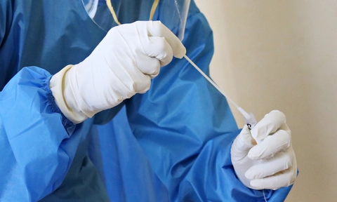 New anti-coagulants discovered in Trinity may help treat sepsis and COVID-19
