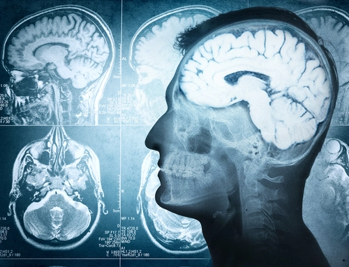 MSc in Medical Imaging