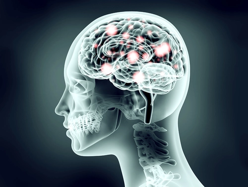 Imaging and cognition