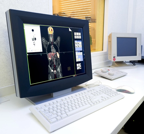 Radiation Therapy scanning