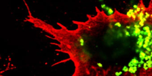 Immunology, Inflammation & Infection