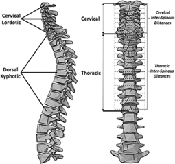 Spine