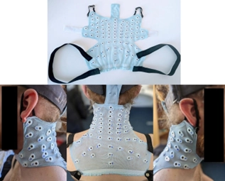 High-density Electrospinography (HD-ESG) Patch Implementation