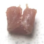 A sample of soft tissue showing damage caused by surgical mesh.