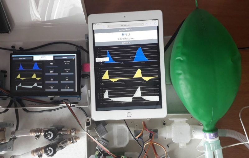 There are multiple options to communicate with the ventilator: a touch screen; a laptop; or a mobile phone can be used to access the user interface and control the device.