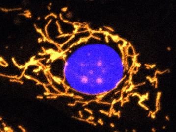 in this image, mitochondria are highlighted in gold. the healthy cell shows a highly elaborate and well-connectednetwork of mitochondria.