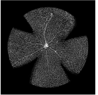 In the photo these are 'art' compositions produced from research material: these are blood vessels in the mouse retina.