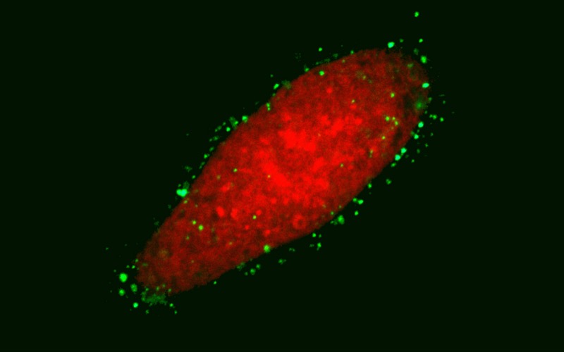 A human oesophageal cell lights up in red after having taken up a photosensitizer. Image credit: Professor Mathias Senge.