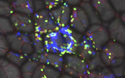 Immune cells (or gd T cells) swarm around fat cells (adipocytes) in fat tissue to regulate their lipid burning vs storage.