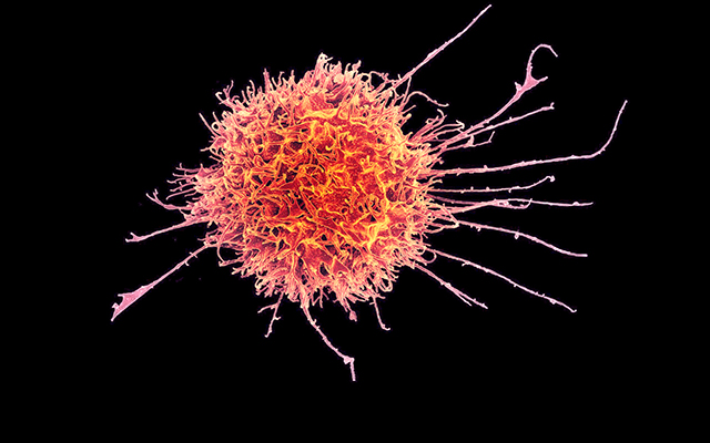 A human Natural Killer (NK) cell, as shown under electron microscope. Image adapted from one owned by National Institutes of Allergy and Infectious Diseases, National Institutes of Health. Adapted under CC BY-NC 2.0 licence.
