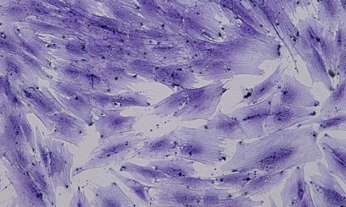 adipose derived stem cells