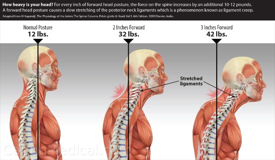 Neck posture