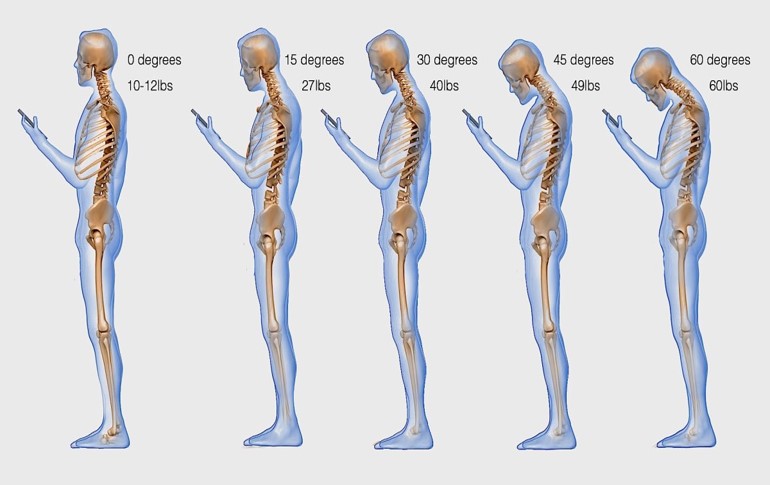 Neck posture by weight