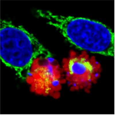 Cell apoptosis.