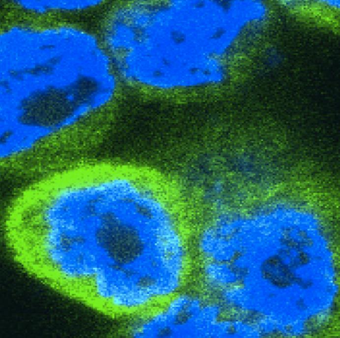Cells expressing inflammatory cytokines stained green