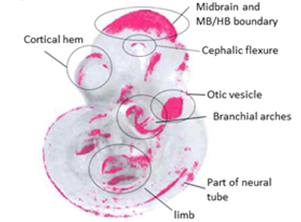 External view of 10.5 day mouse embryo showing the “hot spots” where multiple signalling genes are co-expressed in magenta.