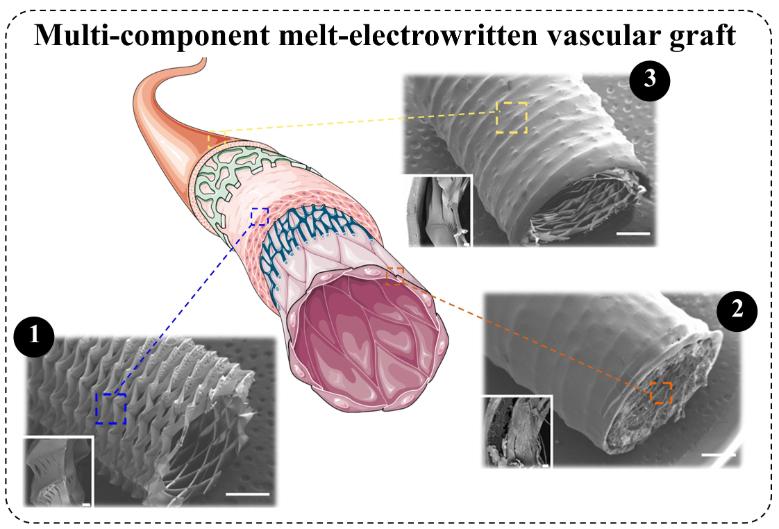 A graphical abstract of the cardiovascular graft, showing how it can help a blood vessel repair.