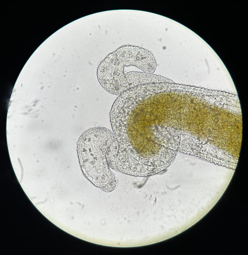 arasite spore clusters (Ordospora colligata) look like black dots within the gut of the host (Daphnia magna). Credit: Niamh McCartan, Trinity College Dublin.