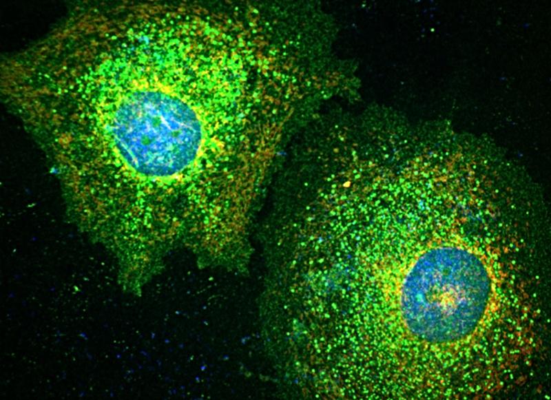 Senescent cancer cells stained for a ‘Death Receptor’ protein that is highly upregulated in response to chemotherapeutic drug treatment. Credit: Prof. Seamus Martin, Trinity College Dublin.