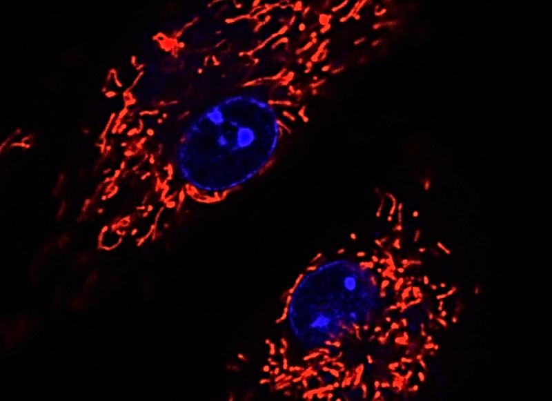 A microscope image of PKM2 in macrophages stained red. Image: