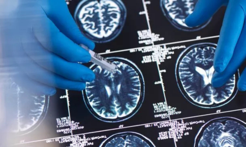 brain