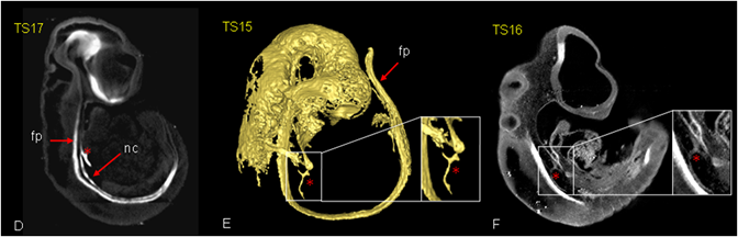 adriamycin treated embryos