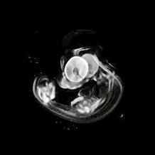 Figure 6: expression of the Sfrp1 gene in a chick embryo at stage HH26- 3D image 3-D