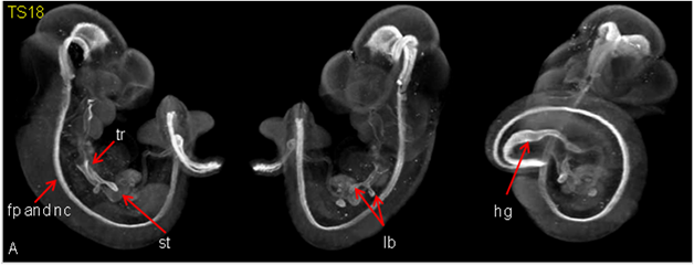 Hnf3b and Optical Projection Tomography