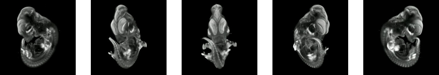 3-Dimensional Representation of Wnt Pathway Gene Expression in the Mouse Embryo