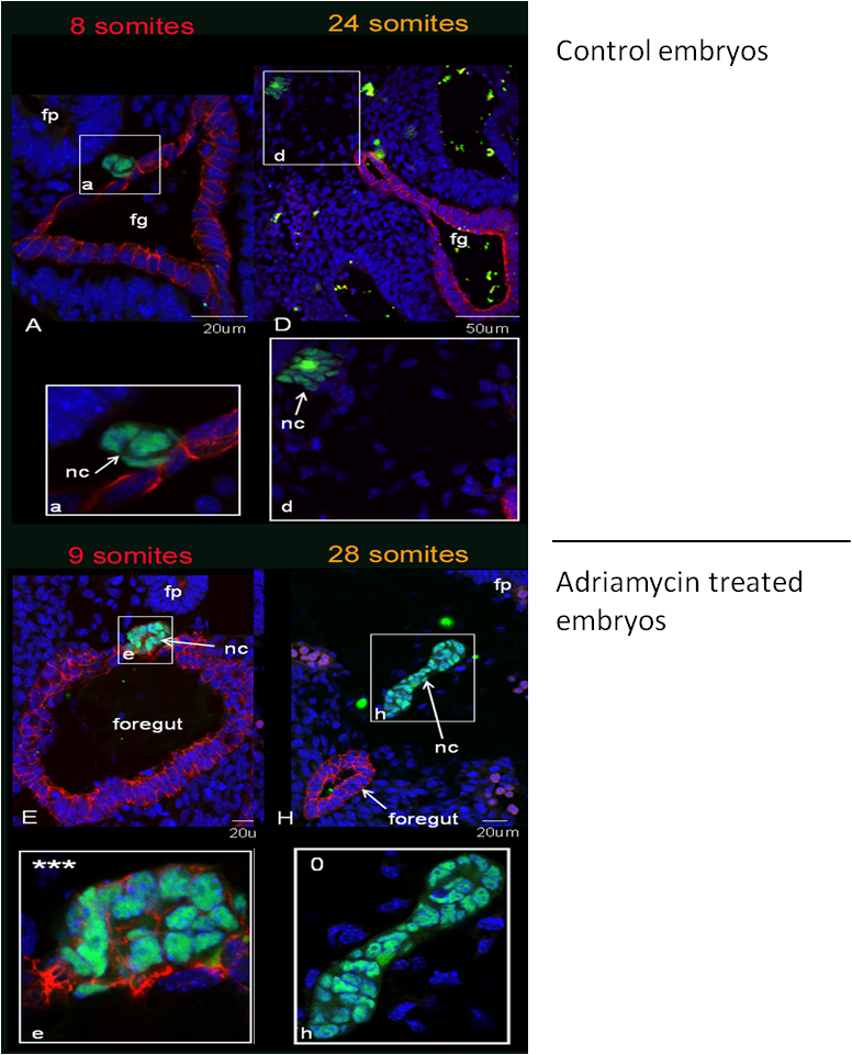 Embryos exposed to adriamycin