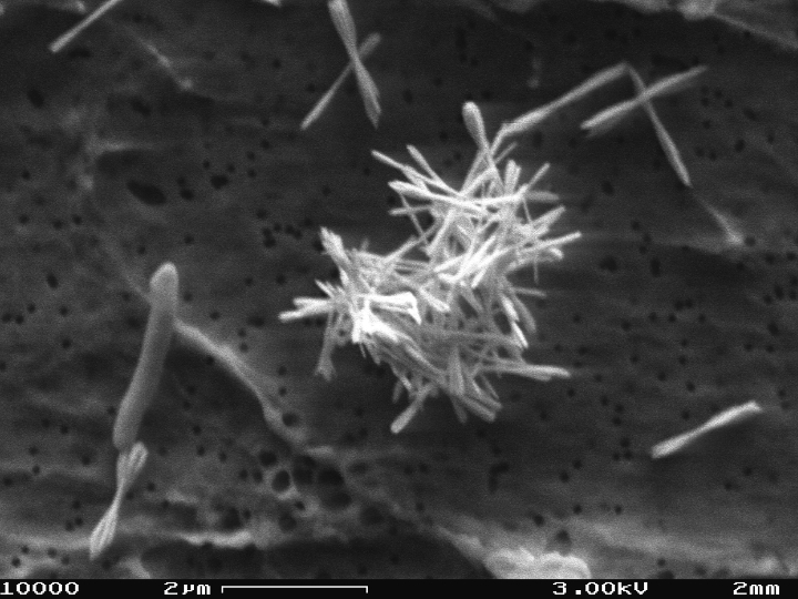 Bacillus beveridgei strain MLTeJB, composed of aggregated Te(0) shards; The bacteria are readily evident as are the surrounding rods. Credit: USGS.