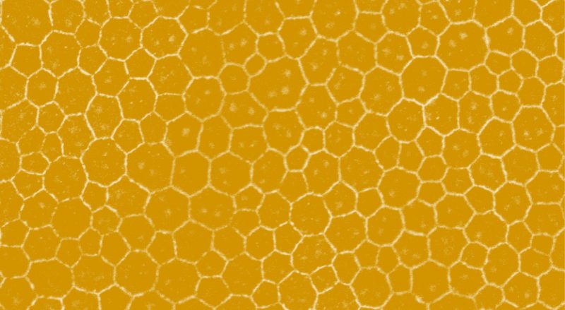 The honeycomb structure of flat mounted retinal pigment epithelial (RPE) cells, that line the back of the eye.