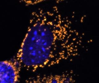 This cell completely lacks OPA1 protein and shows fragmented mitochondria.