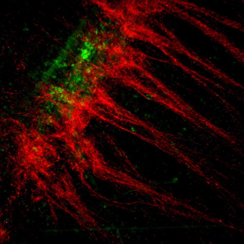 Neurons and inter-neuronal processes projecting through the spinal cord. 