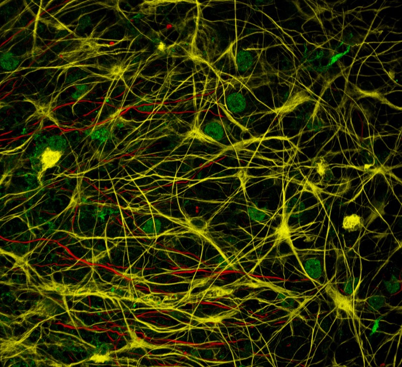 The interaction between neurons (red), astrocytes (yellow) and microglia (green) in one of the lobules of the cerebellum (brain).