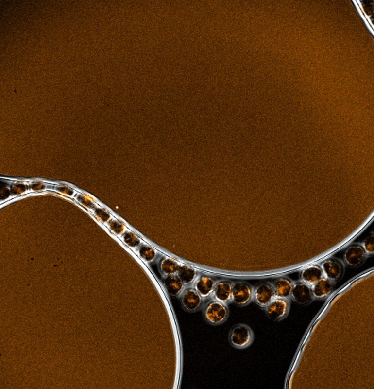 Cell on a G-string: neutrophils cells palisade around an air bubble.