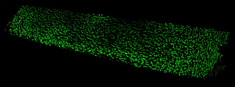 Cell viability in nasal cartilage, showing live and dead cells after cryo-preservation.