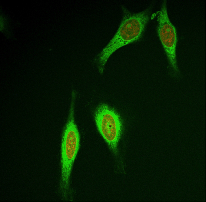 Cervical cancer cells showing green fluorescence from enzyme-activated compound.