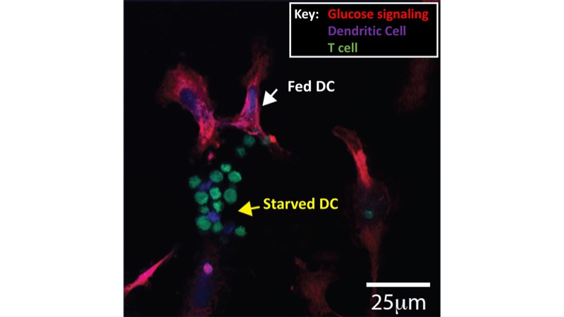 Confocal image showing glucose signalling.