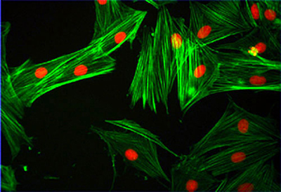 Cardiac cells - this image was generated in the high content research facility, institute of molecular medicine, st james's hospital, by mr connla edwards, dr paul spiers, dr anthony davies and prof yuri volkov.
