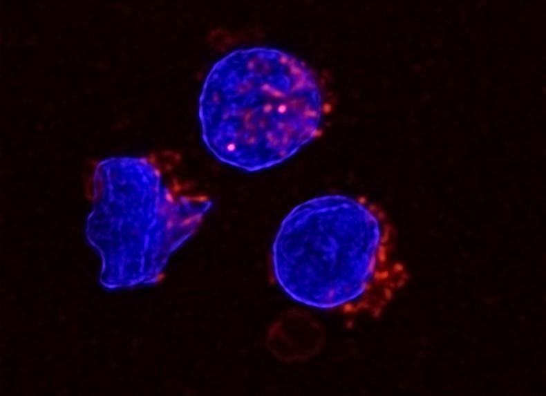 Human NK cells have large nuclei stained in blue and droplets of fat stores stained in red.